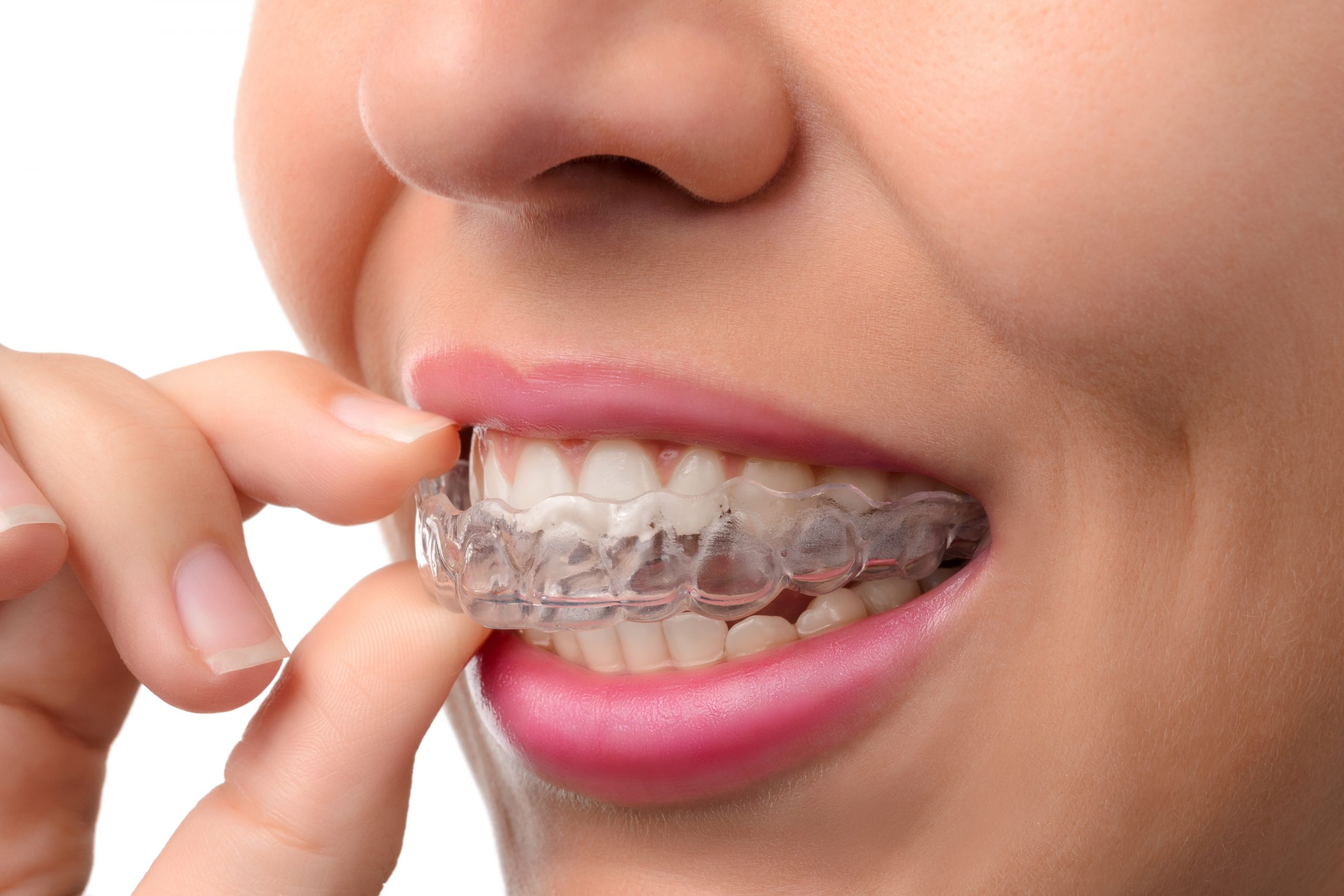 Sept choses à savoir sur les prothèses dentaires