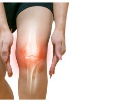Comment améliorer sa qualité de vie malgré la douleur de l’arthrose ?