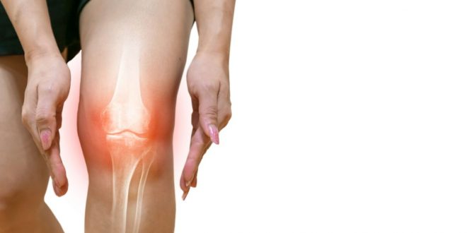 Comment améliorer sa qualité de vie malgré la douleur de l’arthrose ?