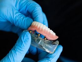 Les questions à poser à votre dentiste avant de choisir une prothèse dentaire