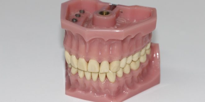 Les idées fausses à dissiper sur les prothèses dentaires